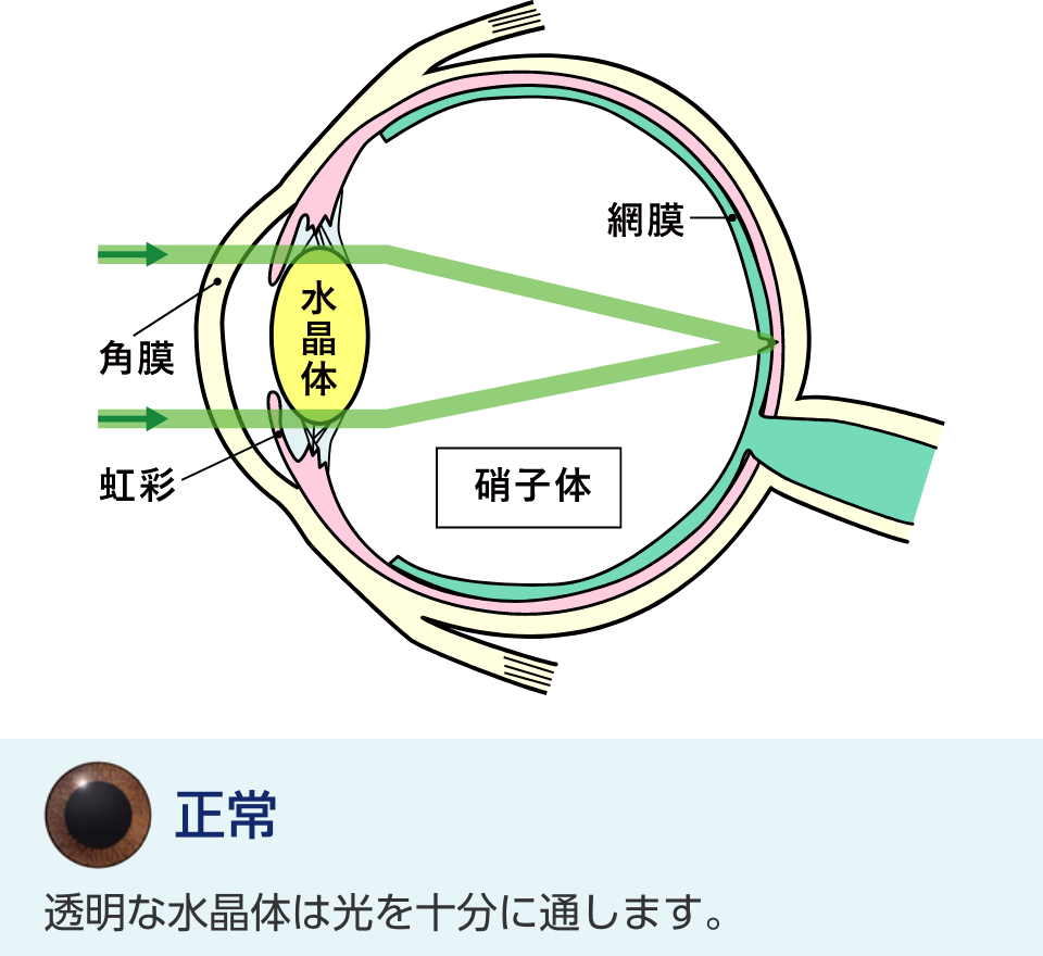 正常
