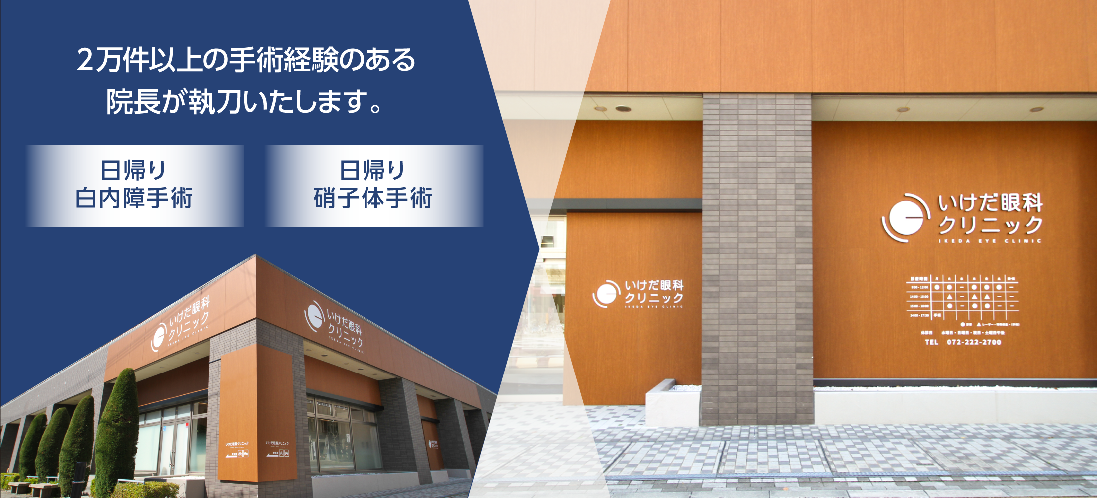2万件以上の手術経験のある院長が執刀いたします。 日帰り白内障手術 日帰り硝子体手術